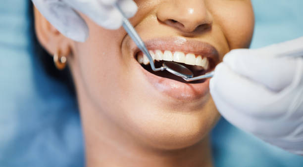Best Emergency Root Canal Treatment in Massanutten, VA